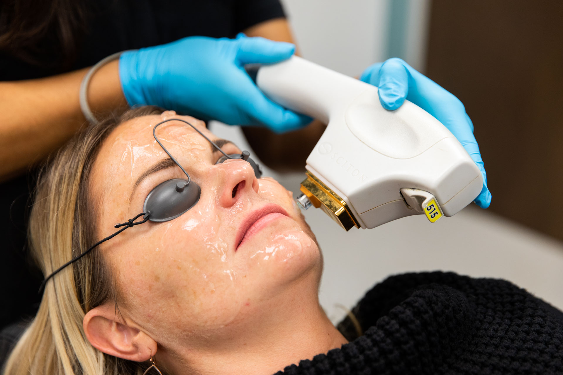 BBL close up procedure